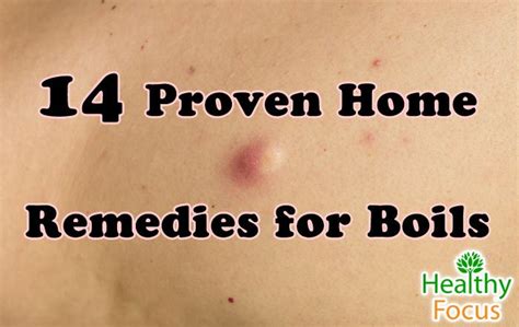 Common Remedies and Medicines For Boils Treatment.